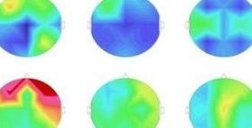 Normy EEG Biofeedback