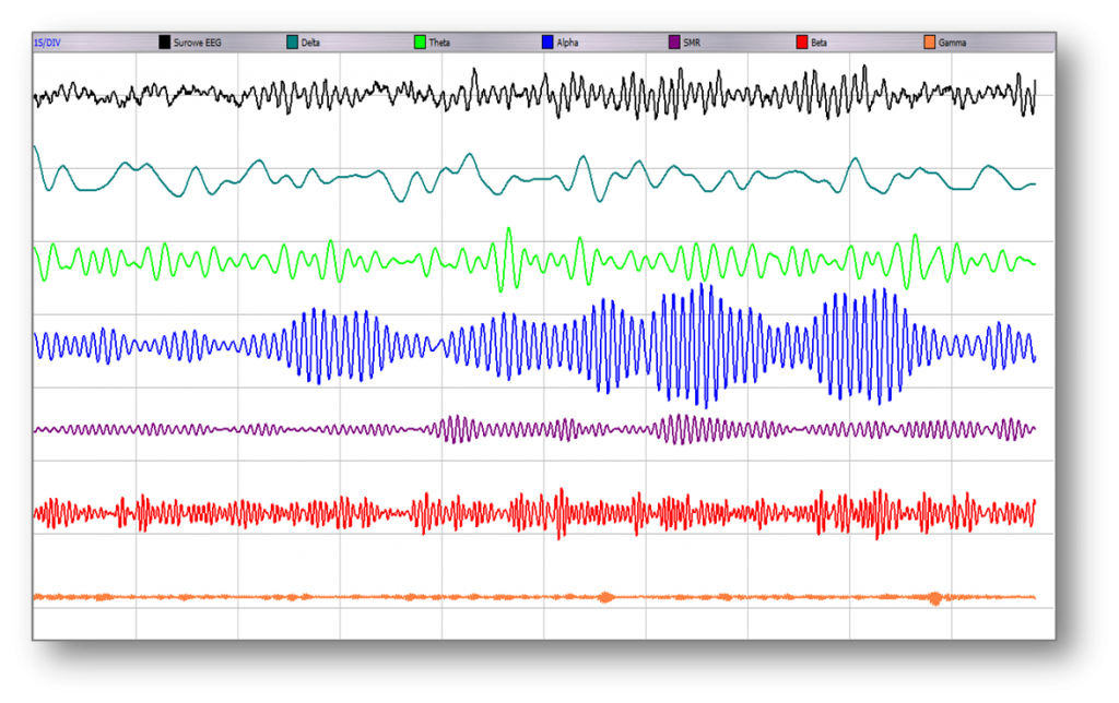 Rytmy EEG