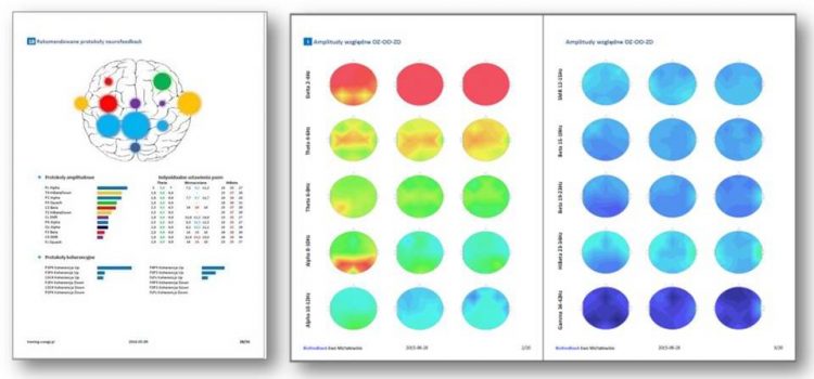Zasady skutecznego biofeedbacku